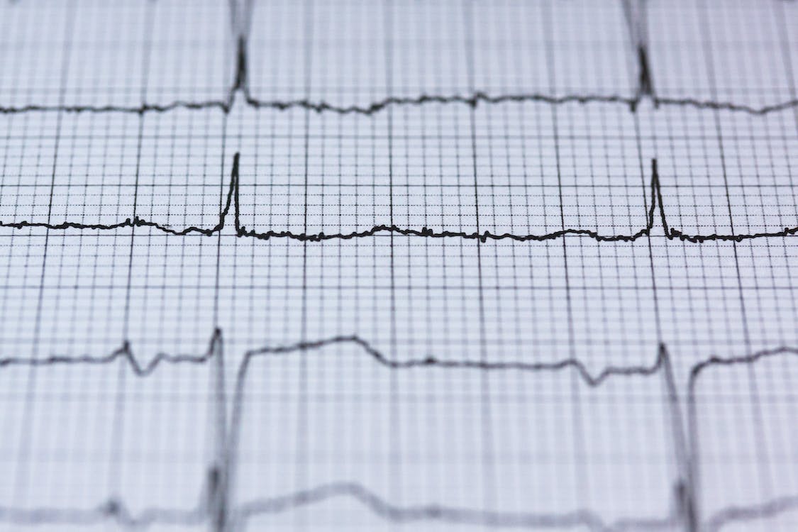 How to Calculate Heart Rate From ECG – The Most Simple Guide